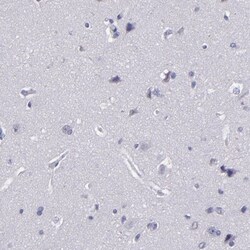 CEBP epsilon Antibody, Novus Biologicals 25 &mu;L | Buy Online | Novus Biologicals | Fisher Scientific