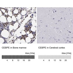 CEBP epsilon Antibody, Novus Biologicals 25 &mu;L | Buy Online | Novus Biologicals | Fisher Scientific