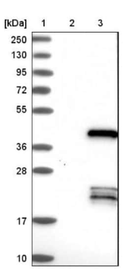 CEBP epsilon Antibody, Novus Biologicals 25 &mu;L | Buy Online | Novus Biologicals | Fisher Scientific