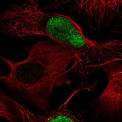 CECR2 Antibody, Novus Biologicals 0.1mL; Unlabeled:Antibodies, Polyclonal