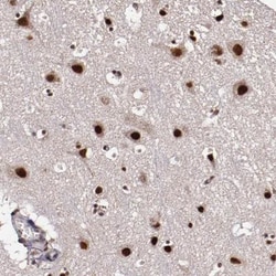 CECR2 Antibody, Novus Biologicals 0.1mL; Unlabeled:Antibodies, Polyclonal