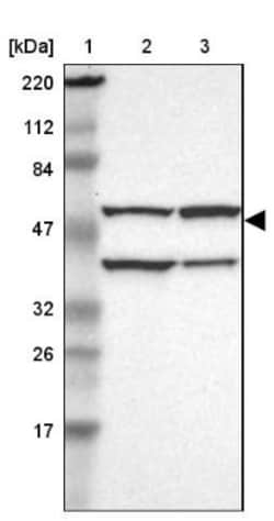 CECR5 Antibody, Novus Biologicals 25 &mu;L, Unconjugated:Antibodies, Polyclonal