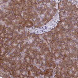 CEMP1 Antibody, Novus Biologicals 0.1mL; Unlabeled:Antibodies, Polyclonal