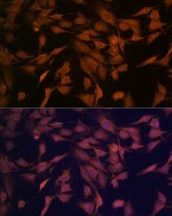 CENPC Rabbit anti-Human, Mouse, Rat, Clone: 5E3K5, Novus Biologicals:Antibodies:Primary