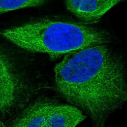 CENPE Antibody, Novus Biologicals:Antibodies:Primary Antibodies