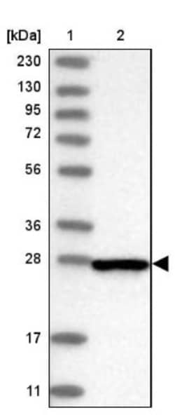CENPH Antibody, Novus Biologicals:Antibodies:Primary Antibodies