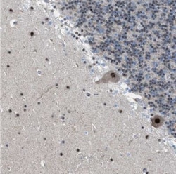 CENPP Antibody, Novus Biologicals:Antibodies:Primary Antibodies