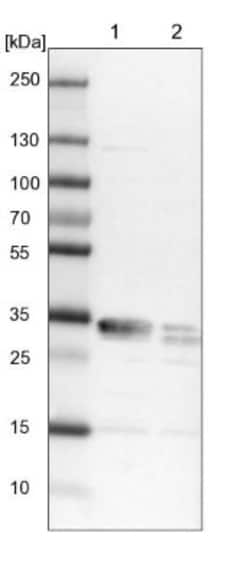 CENPV Antibody, Novus Biologicals 25 &mu;L | Buy Online | Novus Biologicals | Fisher Scientific