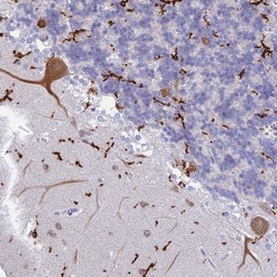 CEP152 Antibody, Novus Biologicals 25 &mu;L | Buy Online | Novus Biologicals | Fisher Scientific