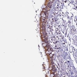 CEP170 Antibody, Novus Biologicals 0.1mL; Unlabeled:Antibodies, Polyclonal