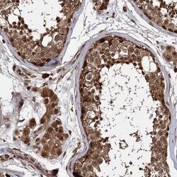 CEP192 Antibody, Novus Biologicals 25 &mu;L | Buy Online | Novus Biologicals | Fisher Scientific