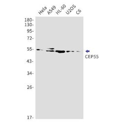 CEP55 Rabbit anti-Human, Mouse, Rat, Clone: S05-6A6, Novus Biologicals:Antibodies:Primary