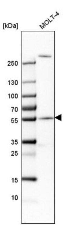 CEP57 Antibody, Novus Biologicals:Antibodies:Primary Antibodies