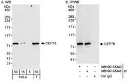 CEP78 Antibody, Novus Biologicals 0.1 mL | Buy Online | Novus Biologicals | Fisher Scientific