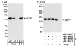 CEP97 Antibody, Novus Biologicals 0.1mL; Unlabeled:Antibodies, Polyclonal