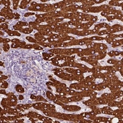 Carboxylesterase 1/CES1 Antibody, Novus Biologicals:Antibodies:Primary