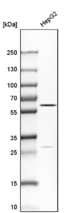 Carboxylesterase 1/CES1 Antibody, Novus Biologicals:Antibodies:Primary