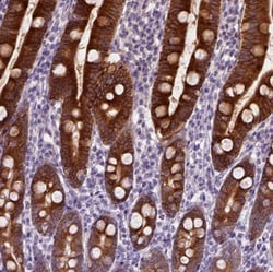 Carboxylesterase 2/CES2 Antibody, Novus Biologicals 25 &mu;L; Unlabeled:Antibodies,