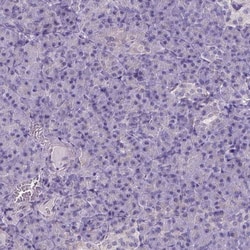 Carboxylesterase 2/CES2 Antibody, Novus Biologicals 25 &mu;L; Unlabeled:Antibodies,
