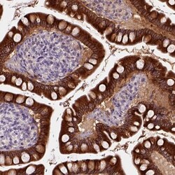 Carboxylesterase 2/CES2 Antibody, Novus Biologicals 25 &mu;L; Unlabeled:Antibodies,