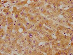 CETP Antibody (2F1), Novus Biologicals 100 &mu;g; Unconjugated:Antibodies,
