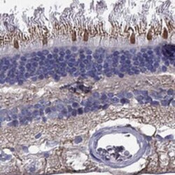 CFAP161 Rabbit anti-Human, Polyclonal, Novus Biologicals 100 &mu;g; Unconjugated:Antibodies,