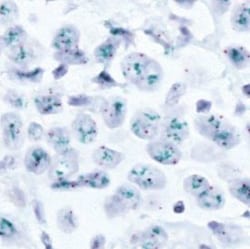 Abnova™ ERBB2/CEN17 CISH Probe
