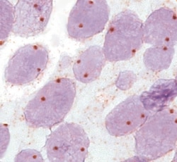 Abnova™ MYCN CISH Probe