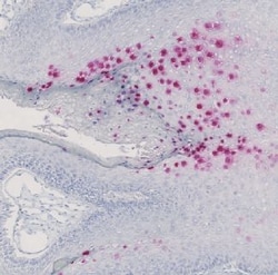 Abnova™ HPV type 6/11 CISH Probe