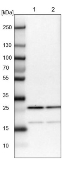 CGGBP1 Antibody, Novus Biologicals 0.1mL; Unlabeled:Antibodies, Polyclonal