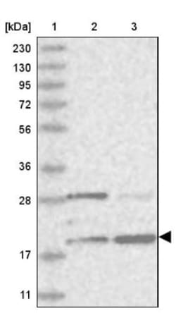 CGGBP1 Antibody, Novus Biologicals 0.1mL; Unlabeled:Antibodies, Polyclonal