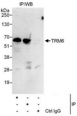 CGI-09 Antibody, Novus Biologicals 0.1mg; Unlabeled:Antibodies, Polyclonal