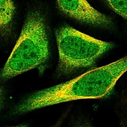 CGI-128 Antibody, Novus Biologicals 0.1mL; Unlabeled:Antibodies, Polyclonal