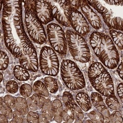 CGI-128 Antibody, Novus Biologicals 0.1mL; Unlabeled:Antibodies, Polyclonal