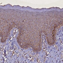 CGI-128 Antibody, Novus Biologicals 0.1mL; Unlabeled:Antibodies, Polyclonal