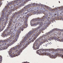 CGI-128 Antibody, Novus Biologicals 0.1mL; Unlabeled:Antibodies, Polyclonal