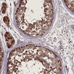 CGI-128 Antibody, Novus Biologicals 0.1mL; Unlabeled:Antibodies, Polyclonal