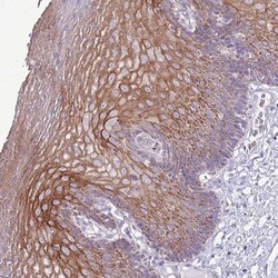 CHAC2 Antibody, Novus Biologicals 0.1mL; Unlabeled:Antibodies, Polyclonal