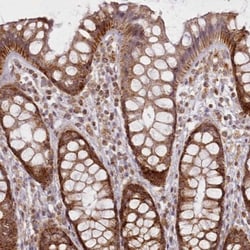 CHCHD2 Antibody, Novus Biologicals 0.1mL; Unlabeled:Antibodies, Polyclonal