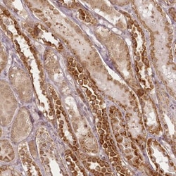 CHCHD2 Antibody, Novus Biologicals 0.1mL; Unlabeled:Antibodies, Polyclonal