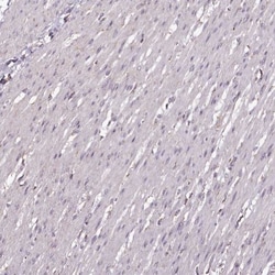 CHCHD2 Antibody, Novus Biologicals 0.1mL; Unlabeled:Antibodies, Polyclonal