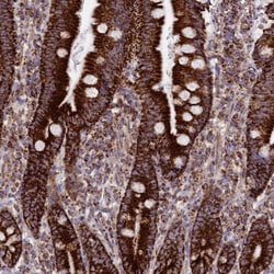 CHCHD3 Antibody, Novus Biologicals 25 &mu;L; Unlabeled:Antibodies, Polyclonal