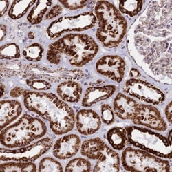 CHCHD3 Antibody, Novus Biologicals 25 &mu;L; Unlabeled:Antibodies, Polyclonal