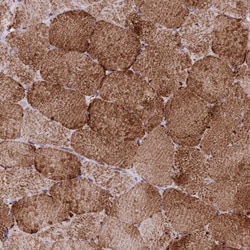 CHCHD3 Antibody, Novus Biologicals 25 &mu;L; Unlabeled:Antibodies, Polyclonal