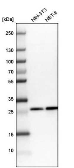 CHCHD3 Antibody, Novus Biologicals 25 &mu;L; Unlabeled:Antibodies, Polyclonal