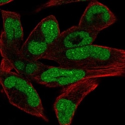 CHD1 Antibody, Novus Biologicals 0.1mL; Unlabeled:Antibodies, Polyclonal