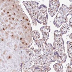 CHD1 Antibody, Novus Biologicals 0.1mL; Unlabeled:Antibodies, Polyclonal