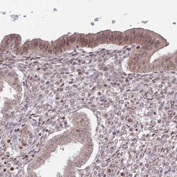 CHD1 Antibody, Novus Biologicals 0.1mL; Unlabeled:Antibodies, Polyclonal