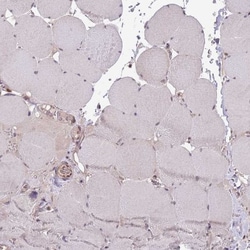 CHD1 Antibody, Novus Biologicals 0.1mL; Unlabeled:Antibodies, Polyclonal