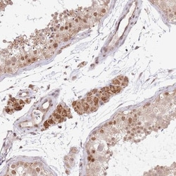 CHD1 Antibody, Novus Biologicals 0.1mL; Unlabeled:Antibodies, Polyclonal